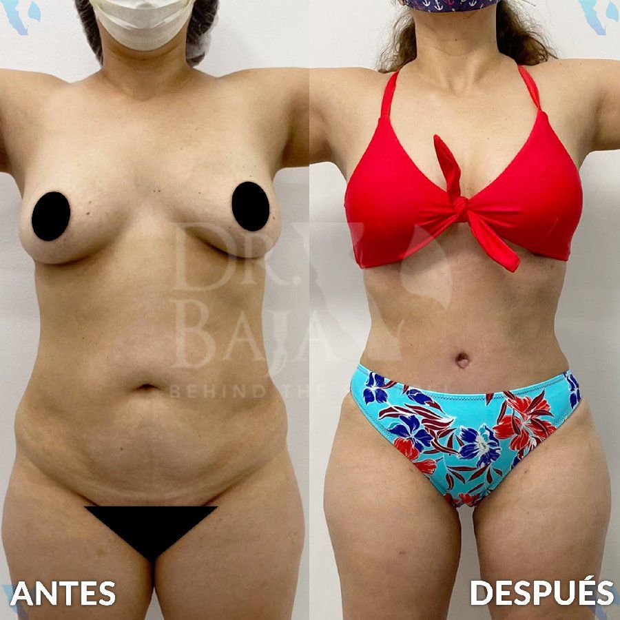 Renato Rodríguez Hirales-27