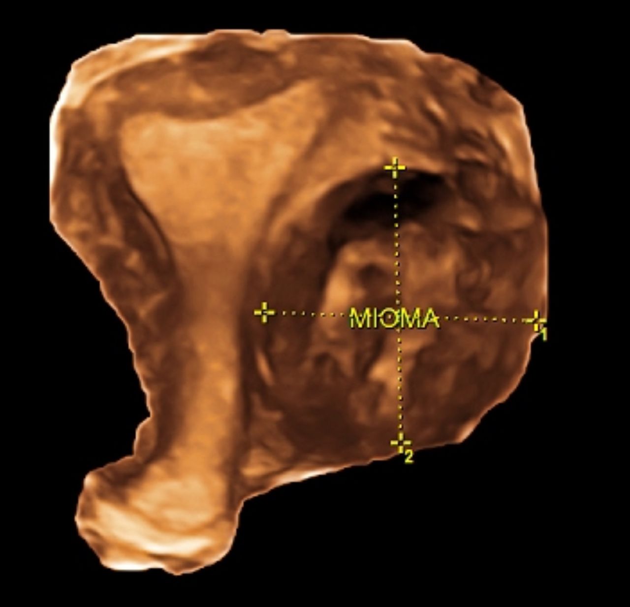 Azael Jiménez Bonola-11