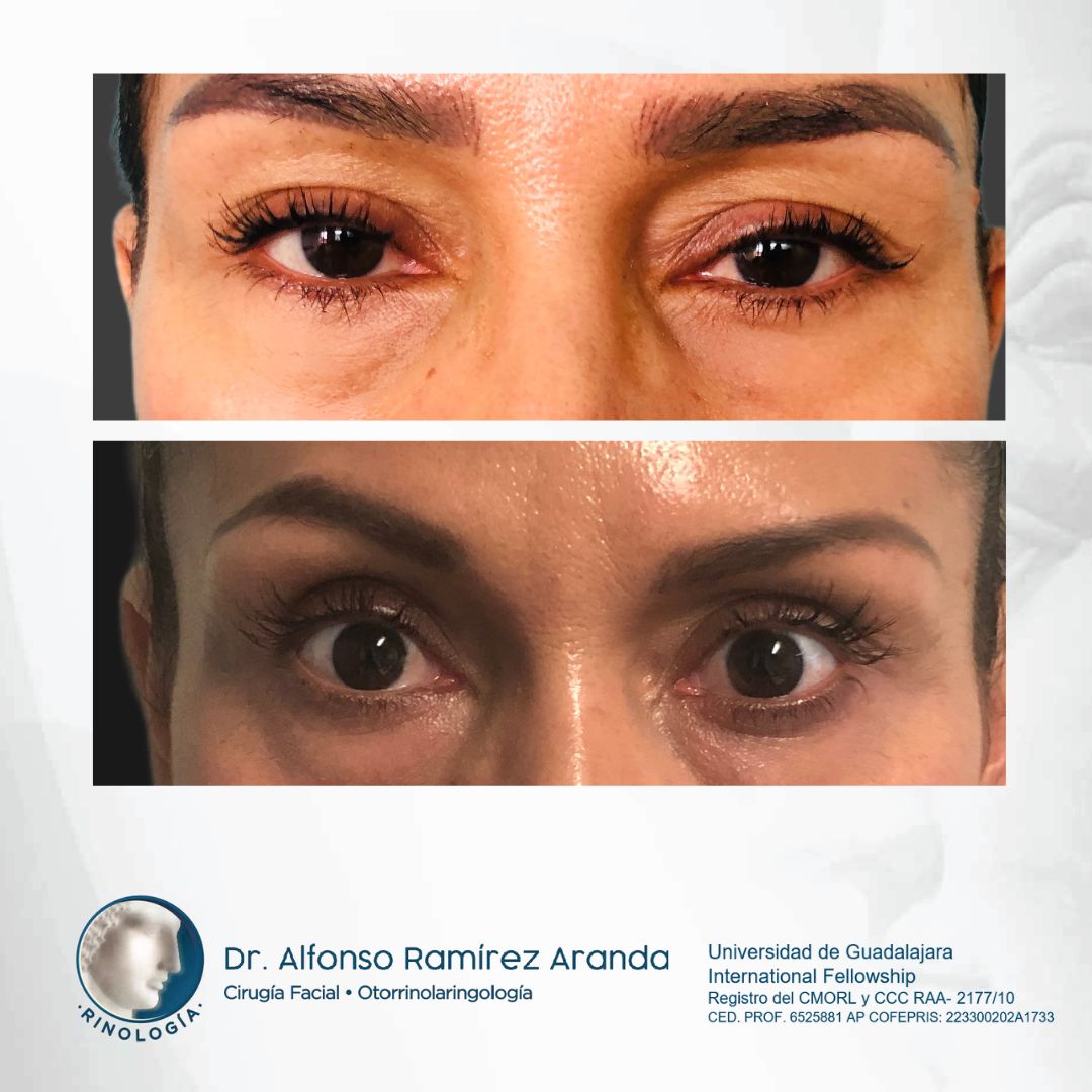 Alfonso Ramírez Aranda-7