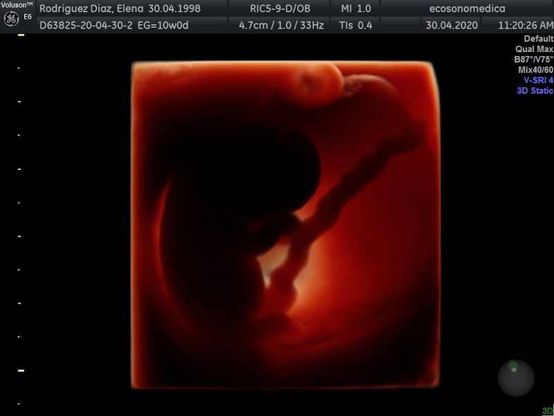 Héctor Bernardo Acevedo Manrique-6