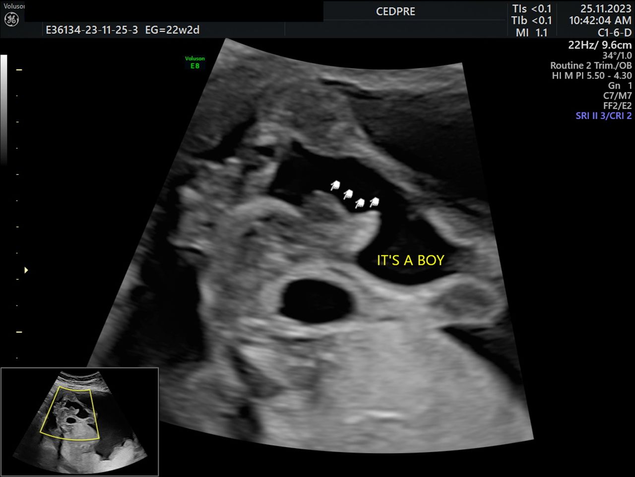 Brenda Dzul García-6