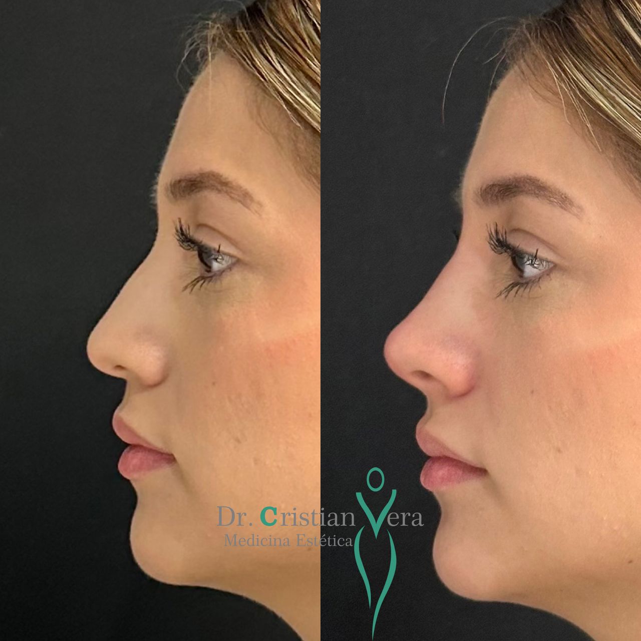 Cristian Eduardo Vera Nuño-18