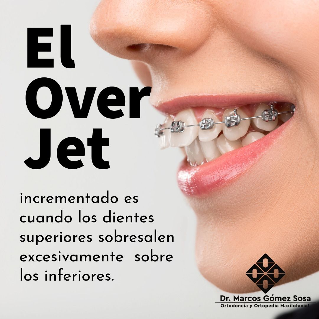 Marcos Gómez Sosa-32