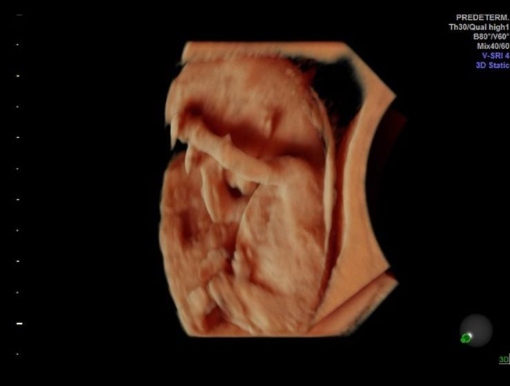 Graciela Elizabeth De La Torre Alvarez-23