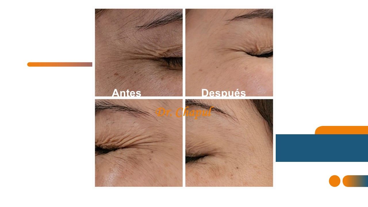 José Luis Muñoz Chapul-27