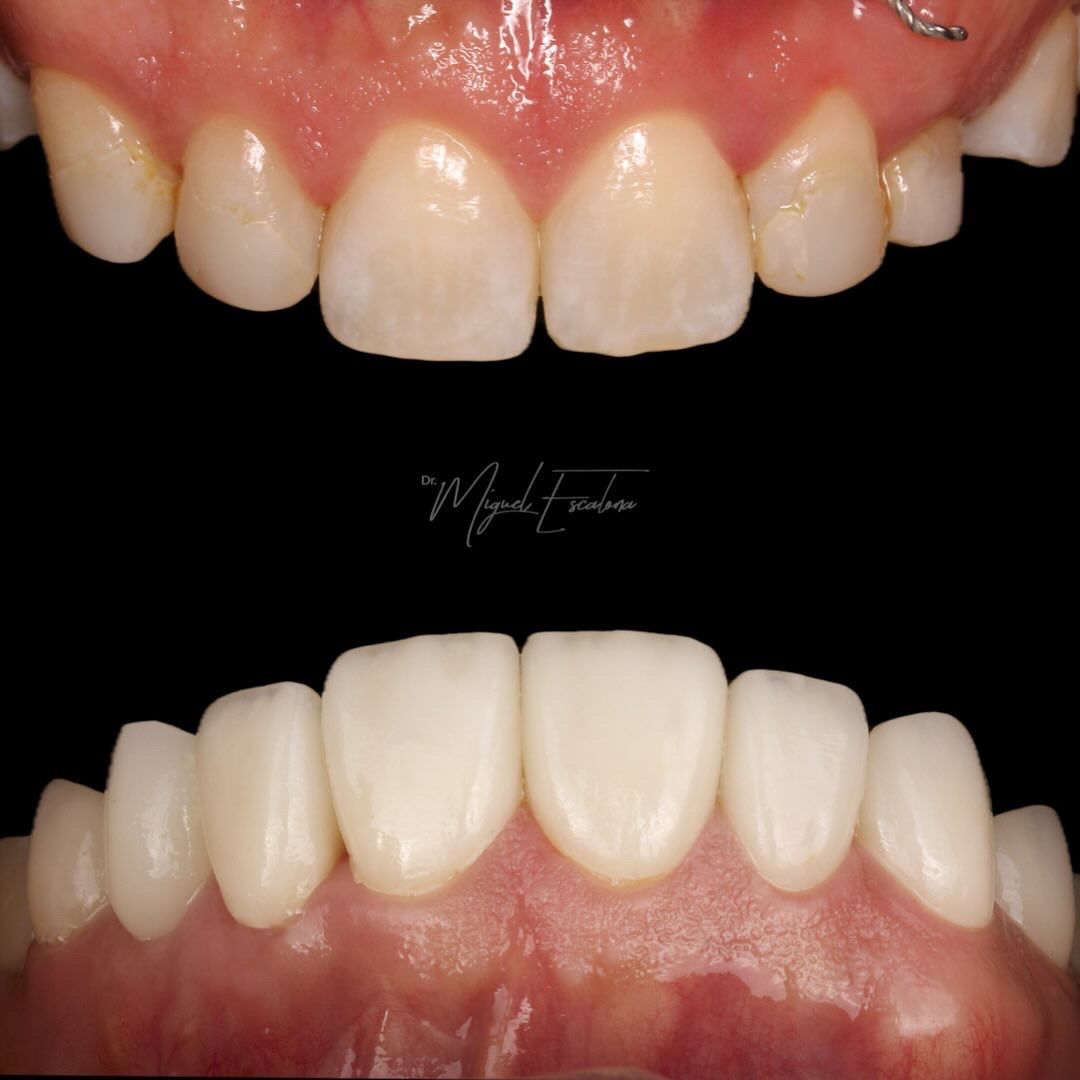 Miguel Alberto Escalona Mora-3