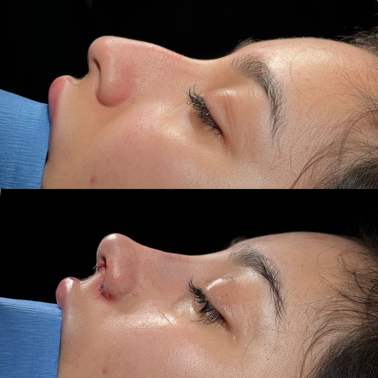 Angel Castro Urquizo-211