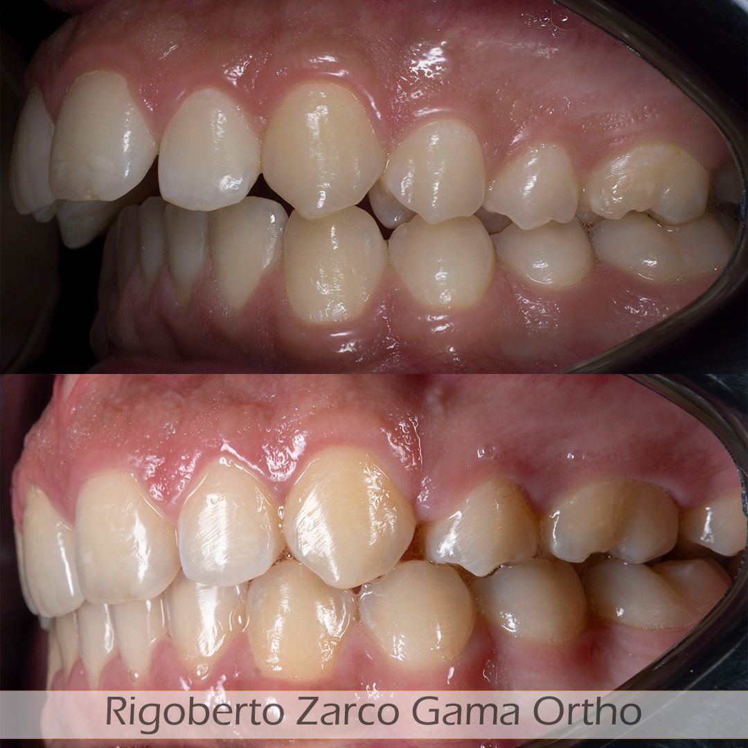 Rigoberto  Zarco Gama-4