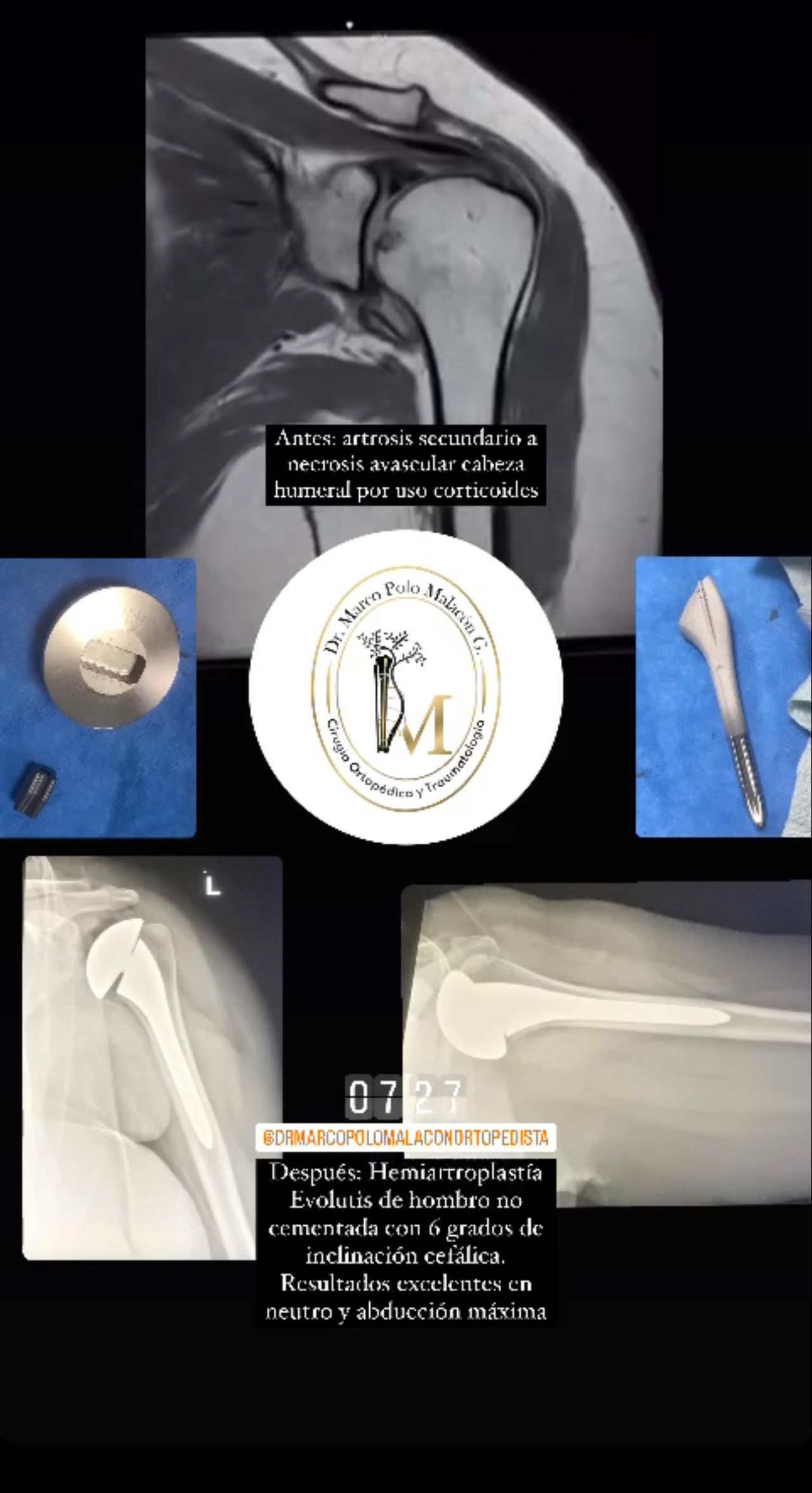 Marco Polo Malacón Gutiérrez-25