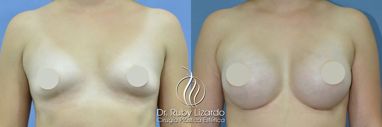 Ruby Lizardo Ramírez Robles-20