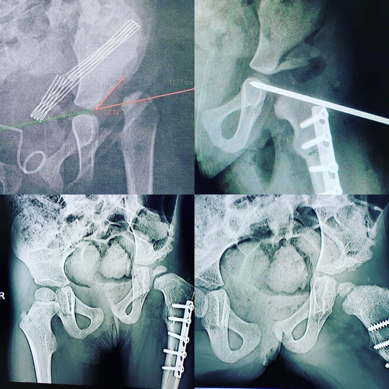 Alfonso Meza Vernis-86