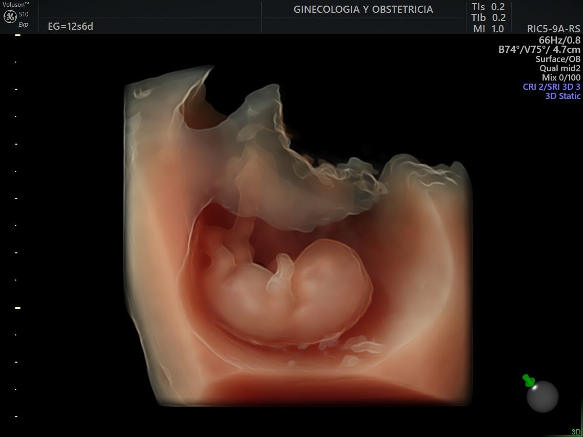 Juan Jose Pacheco Uc-8