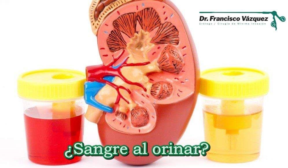 Francisco Vázquez Venegas-7