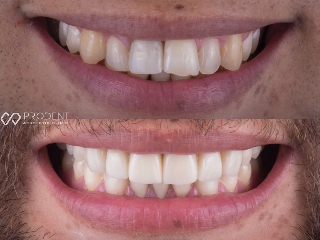 Ulises Pérez Murillo-42