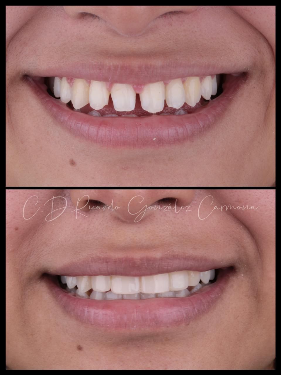 Alicia Carmona López-0