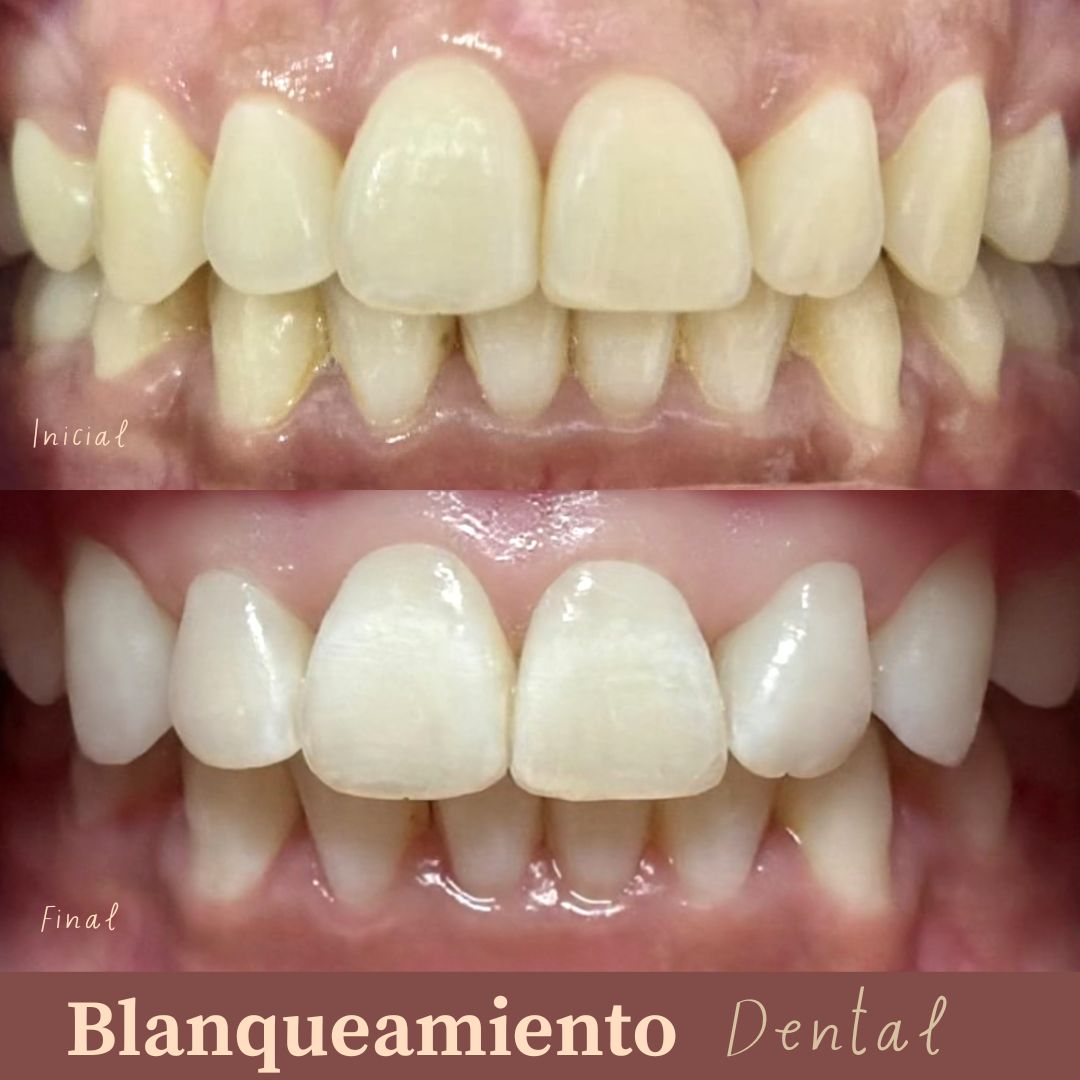 Ana Lisset Rangel Miranda-1