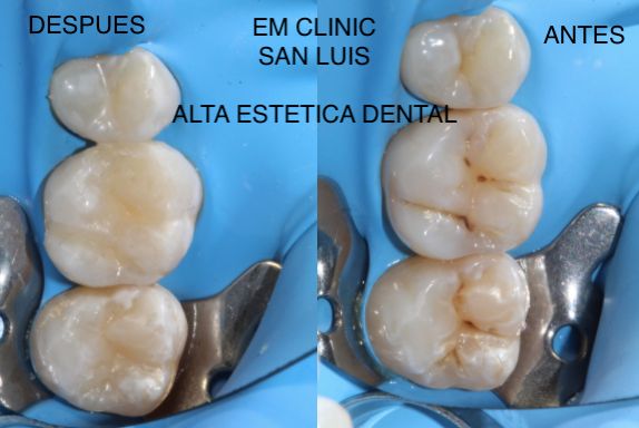 Erika Díaz De León Torres-15