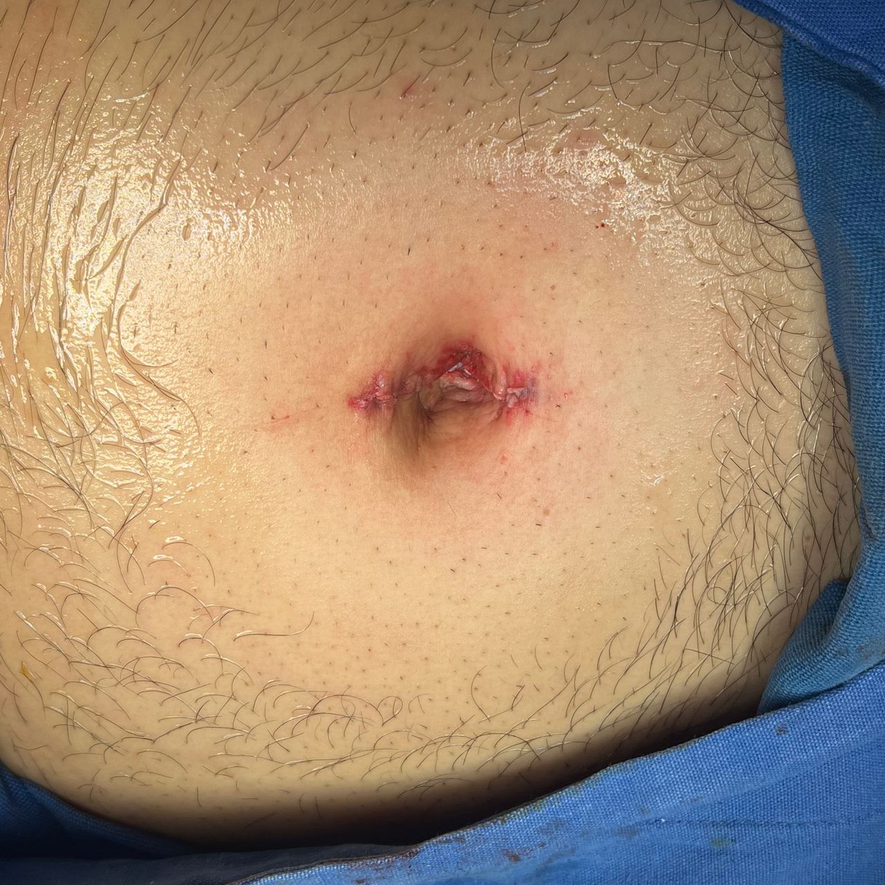 Bernardo Álvarez Hernández-5