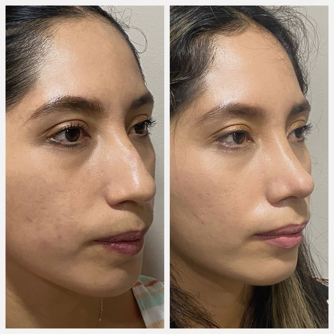 Alejandro Jimenez Garcia-51