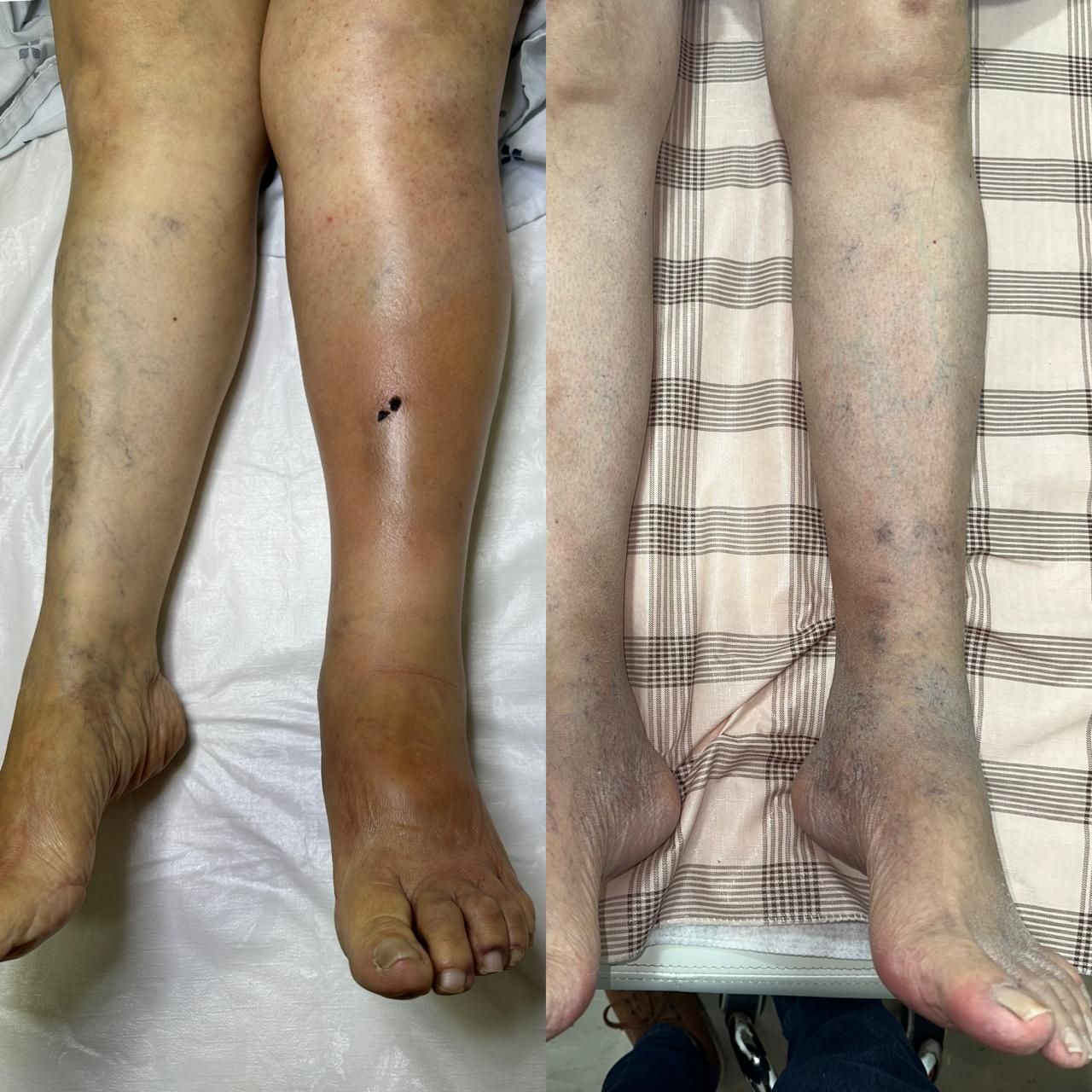 Jhonatan López González-51