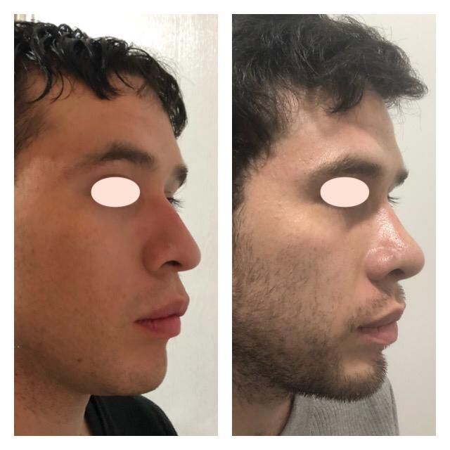 Carola Berenice Curiel Davalos-34