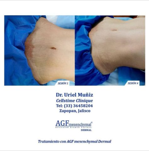 Teófilo Uriel Muñiz Chávez-48