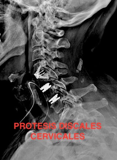 Jesus Rocha Maguey-2