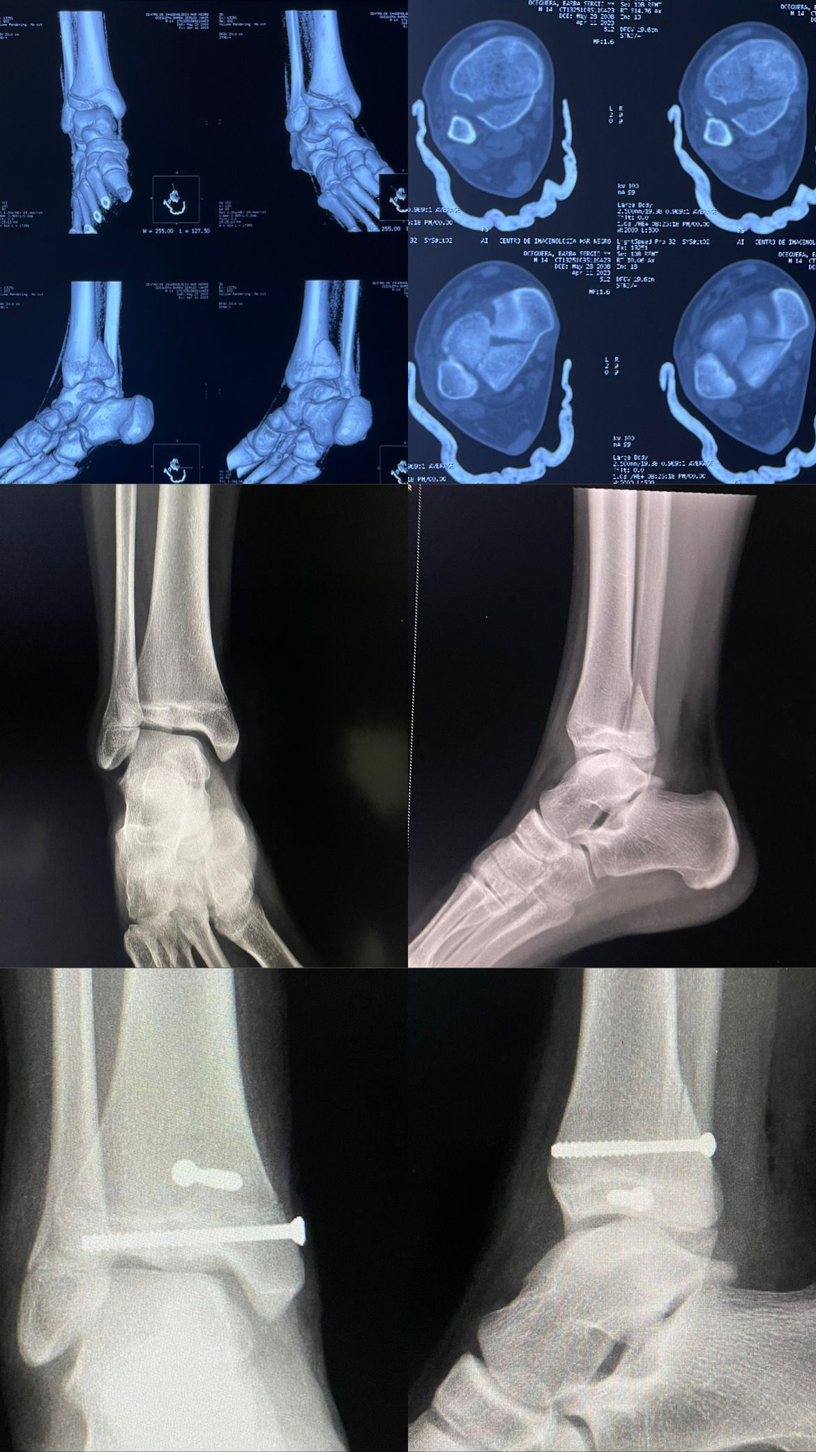 Cristian Ernesto Murillo Medina-22