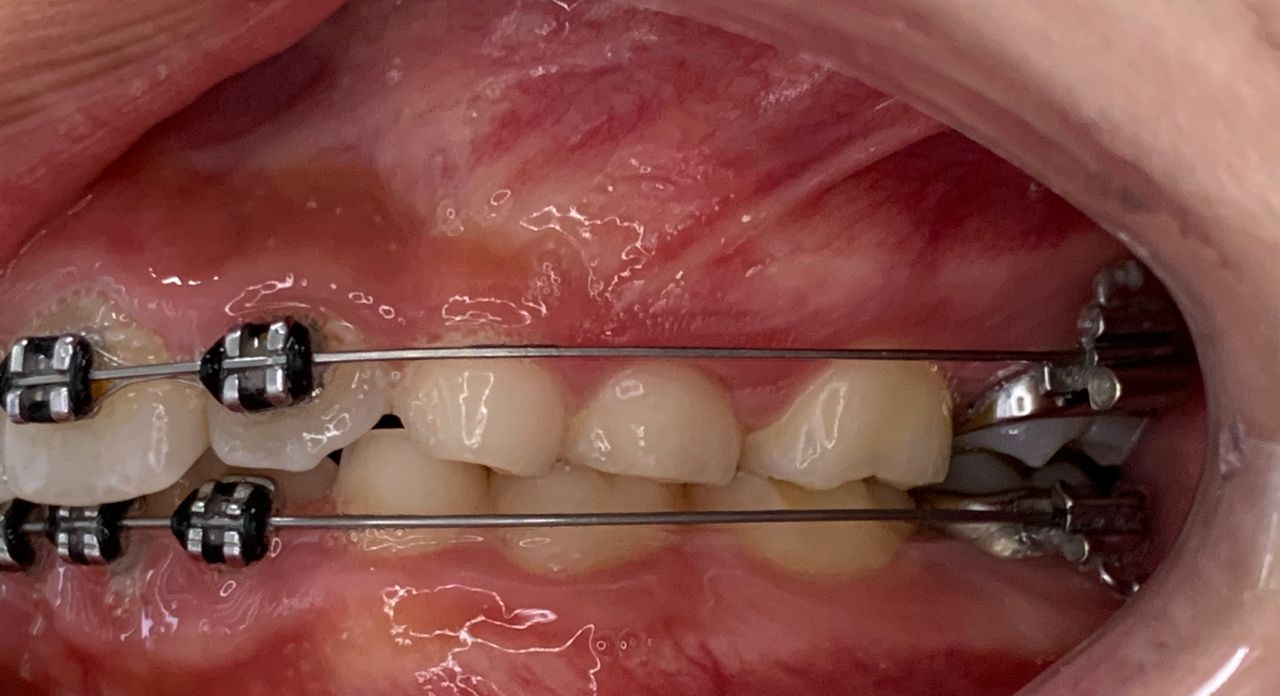 Patricia Rizo Palos-6