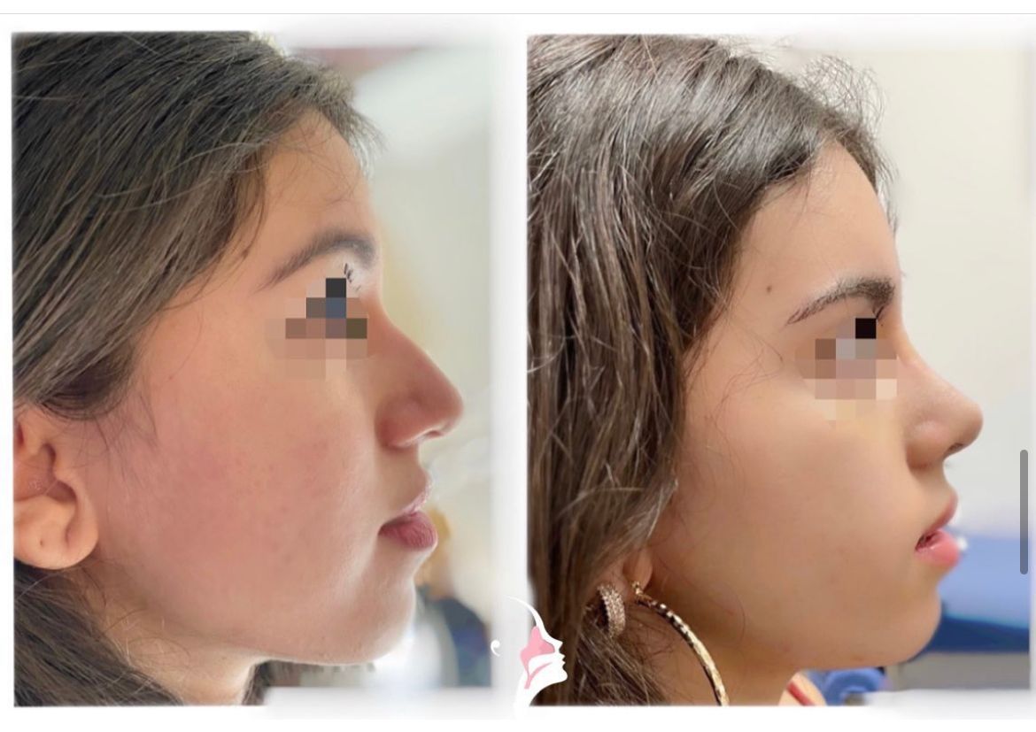 E. Carolina Vásquez Rafael-12