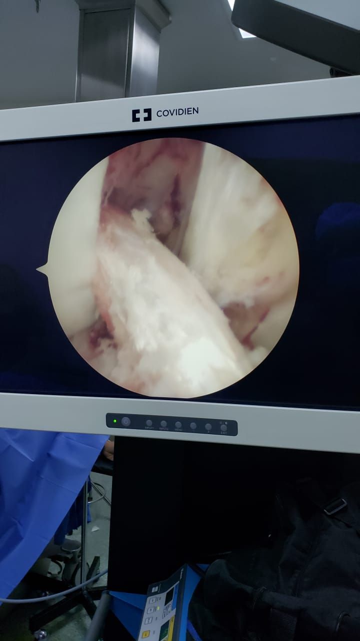 Moises Moreno Martinez-1