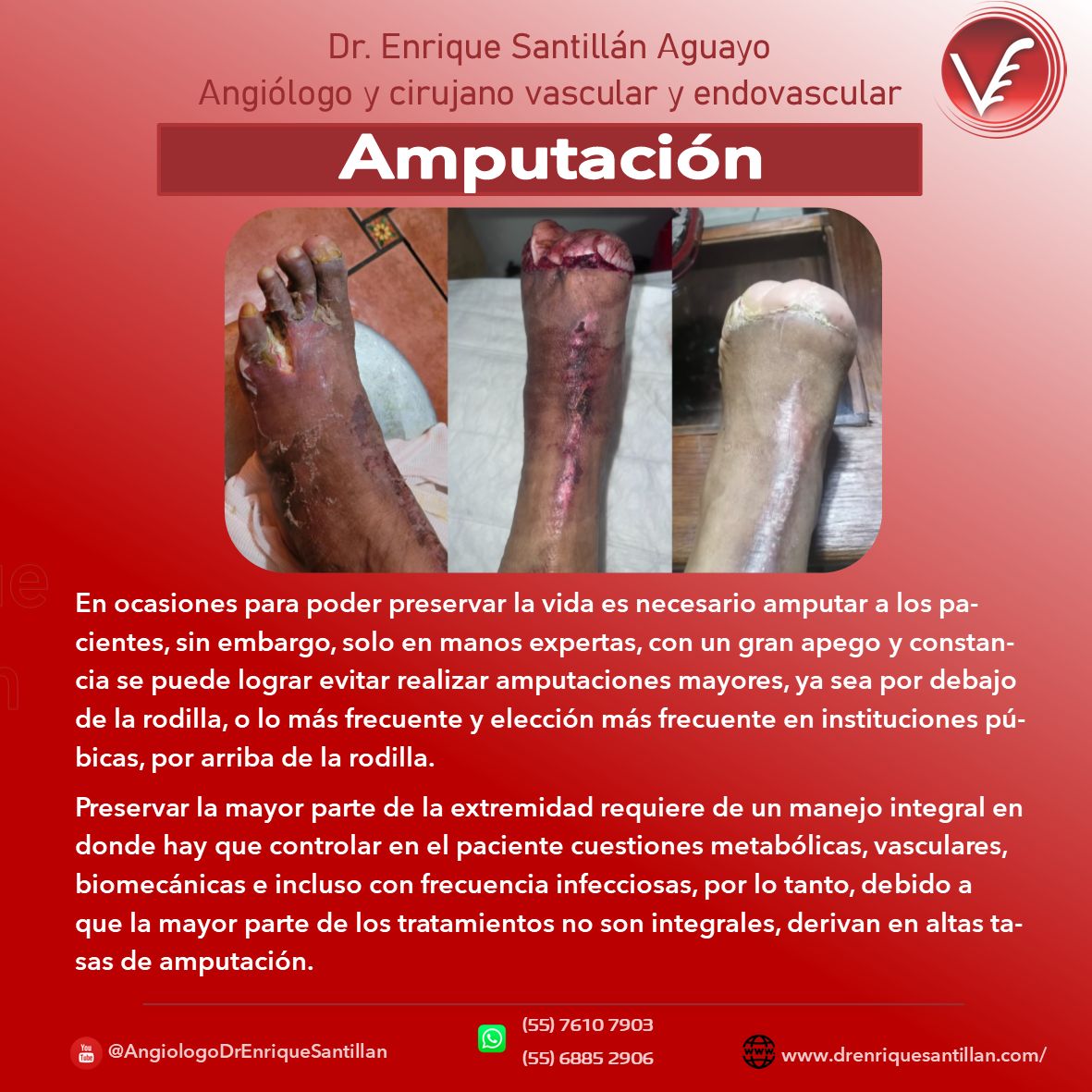 Enrique Santillán Aguayo-8