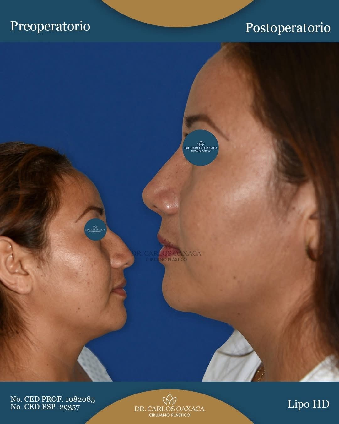 Carlos Guillermo Oaxaca Escobar-5