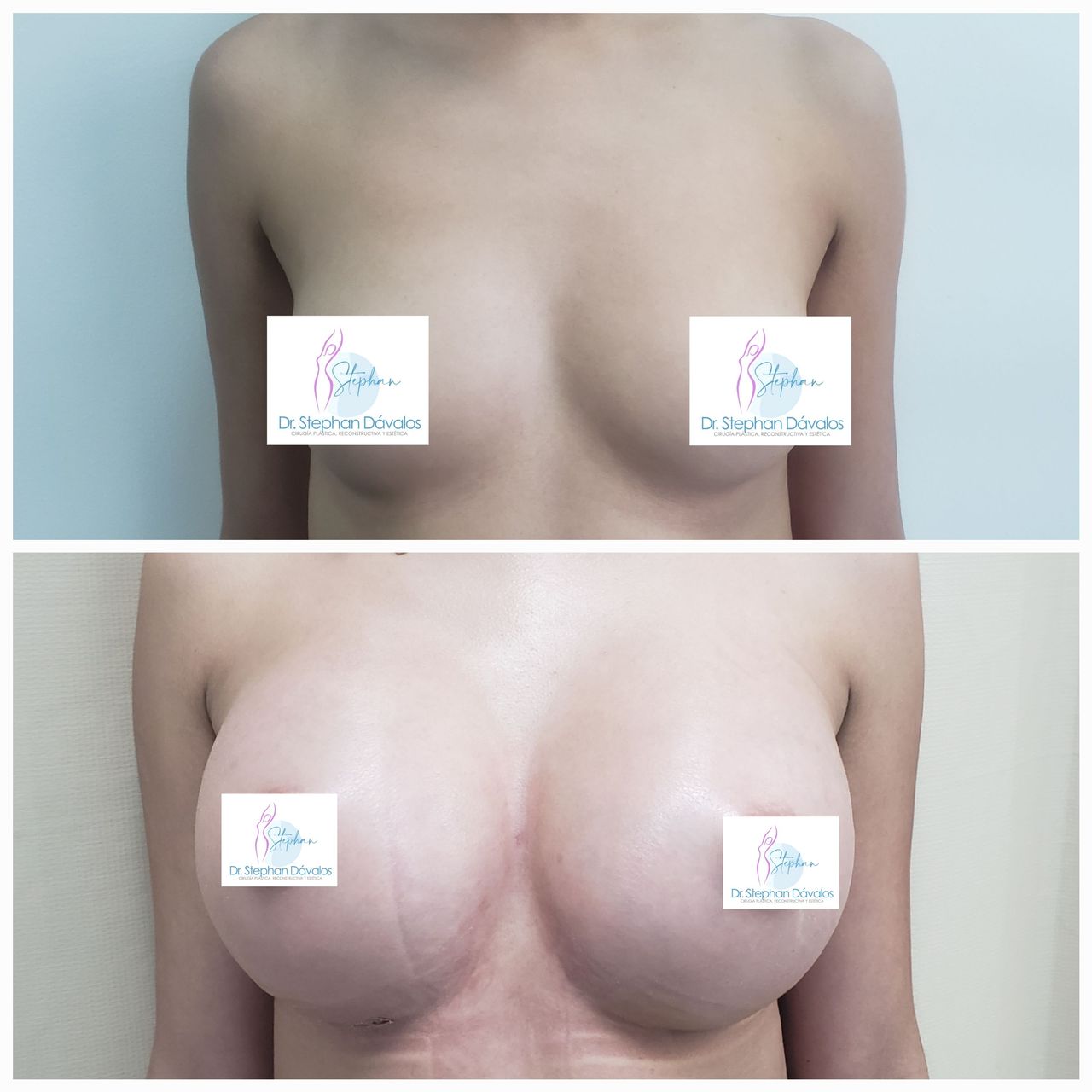 Stephan Dávalos Barrios-14