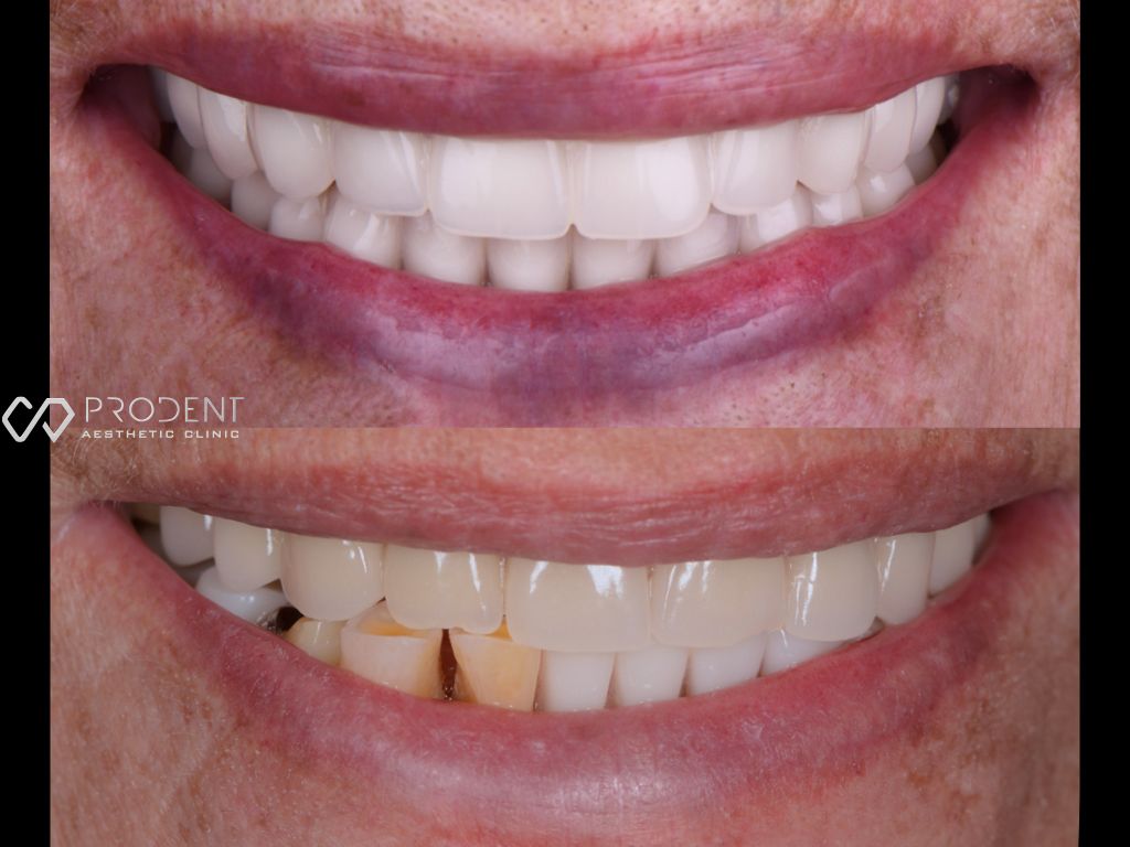 Ulises Pérez Murillo-80