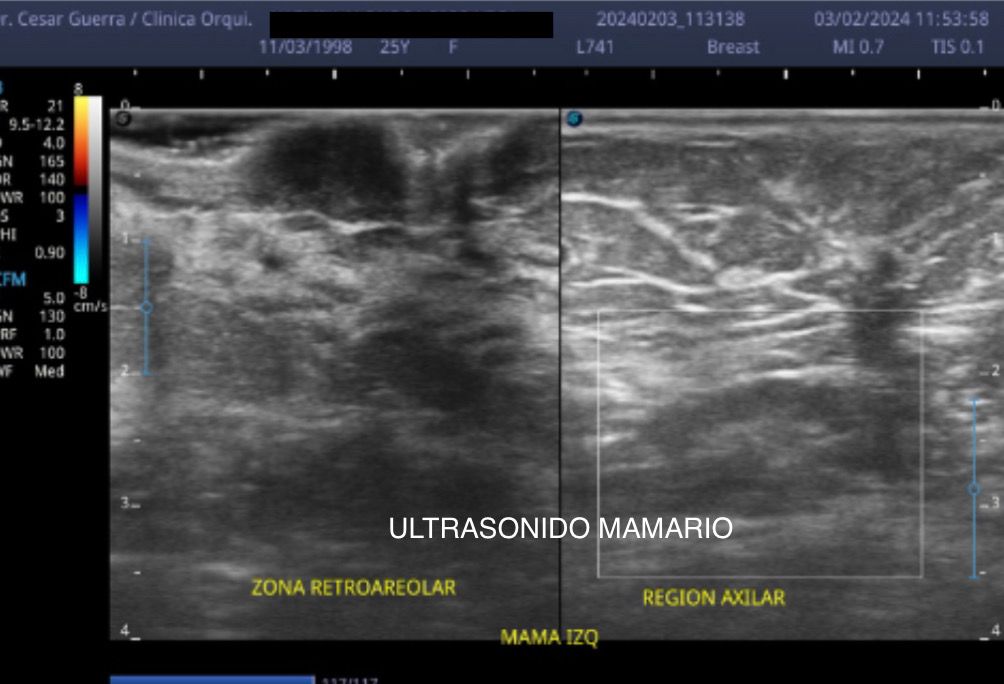 César Guerra Martínez-39