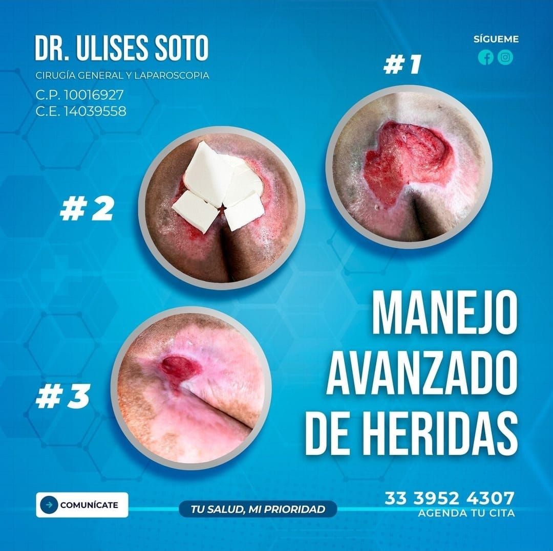 Ulises Soto Calvario-1