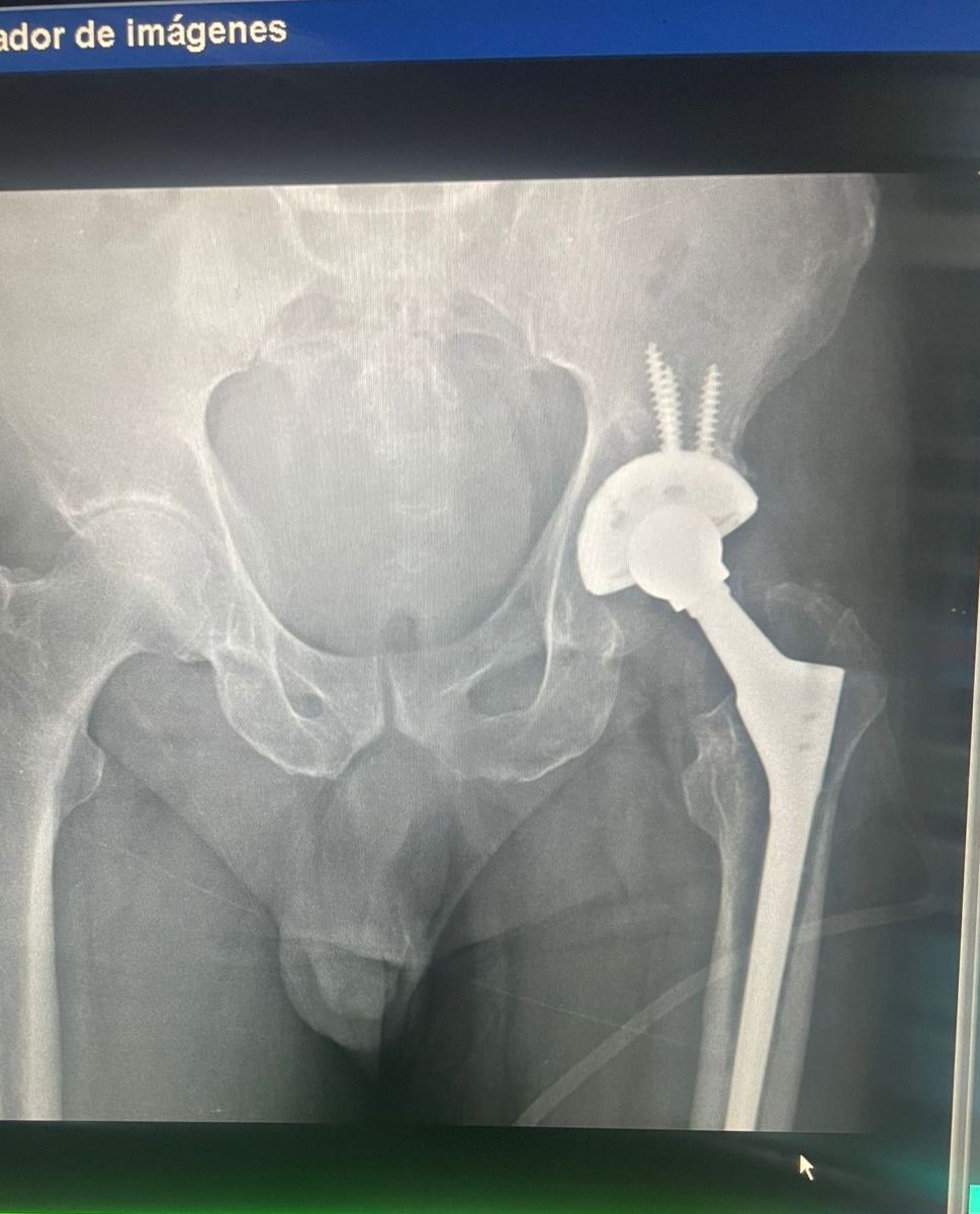 Max Georges Sainte Bernal-13