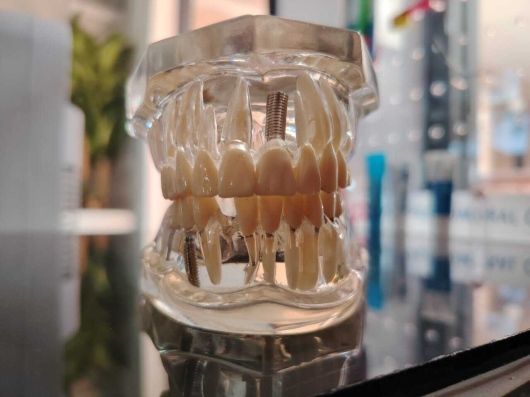 Nivis Avyely Leyva Castrejón-4