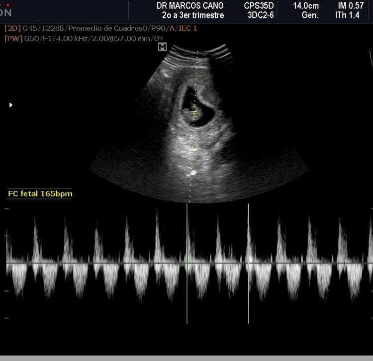 Marcos Javier Cano Luna-4
