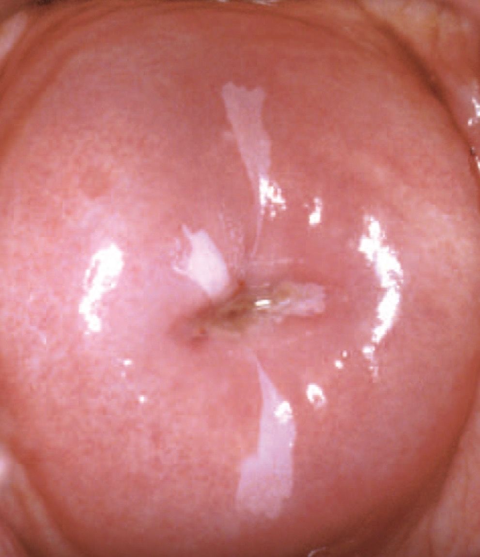 Pilar Arroyo Tenorio-6