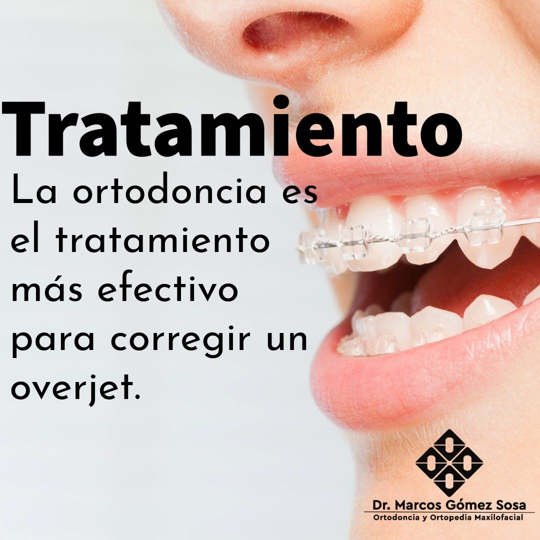 Marcos Gómez Sosa-39