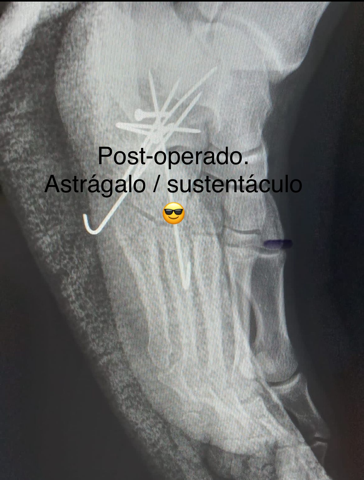 Emmanuel Bolaños Cortes-3