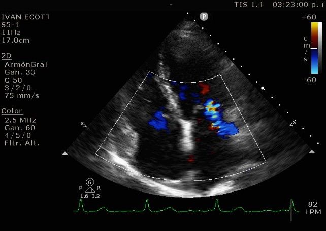 Iván A. Barreto Alanis-0