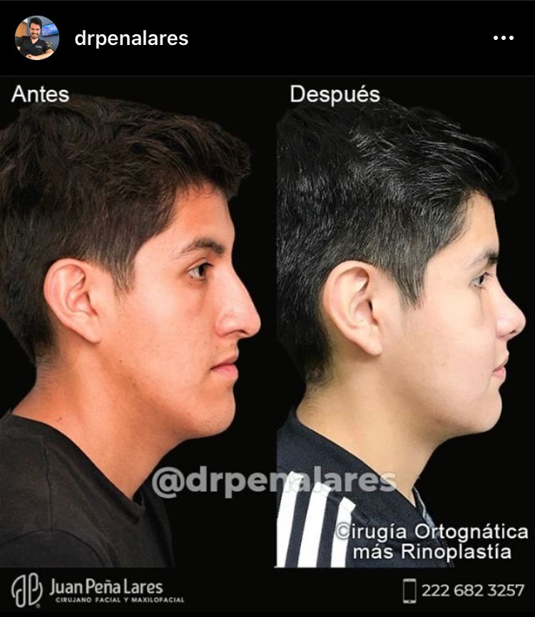 Juan Peña Lares-48