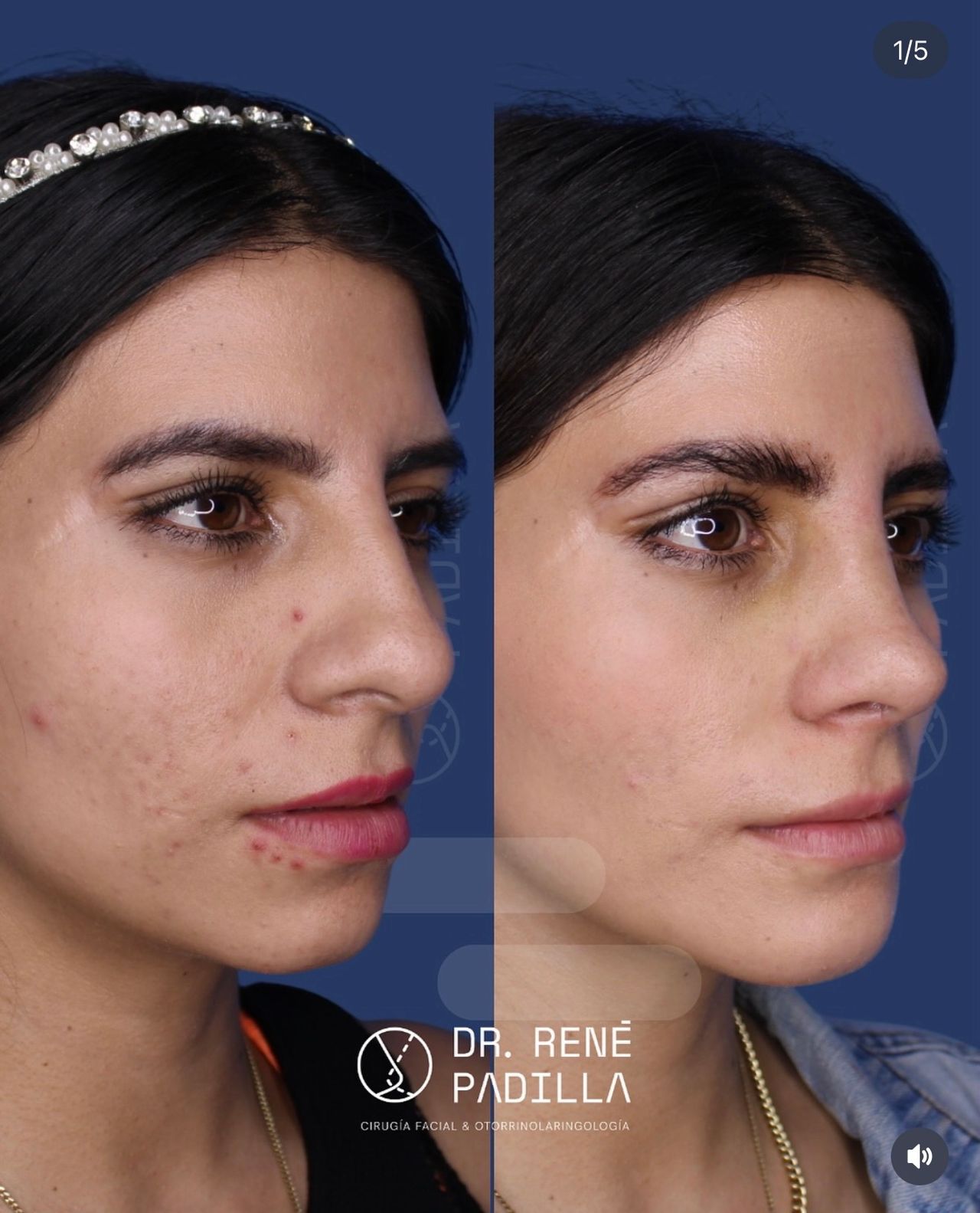 René Emmanuel Padilla López-17