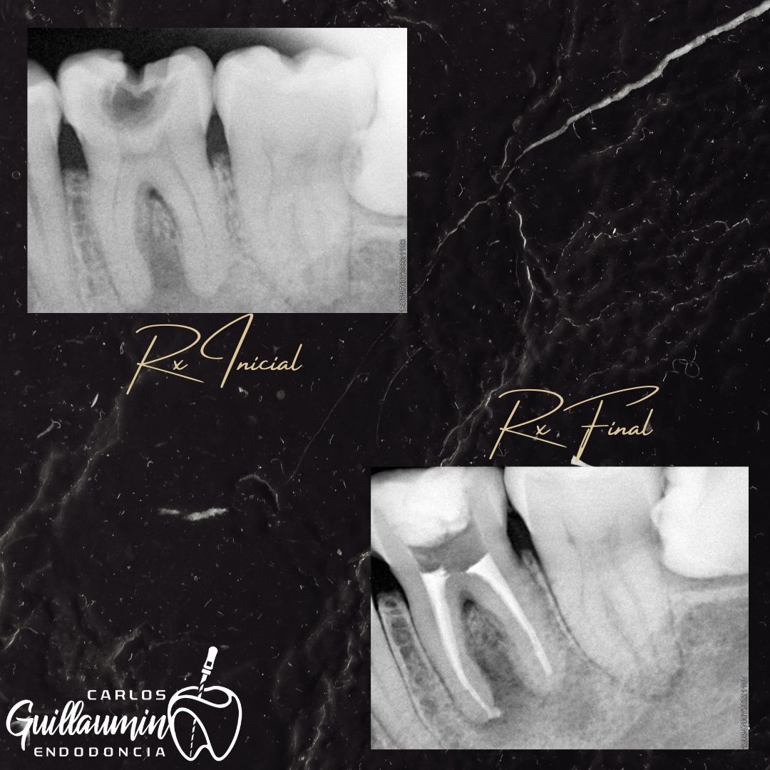 Carlos Gilberto Guillaumin Esparza-3