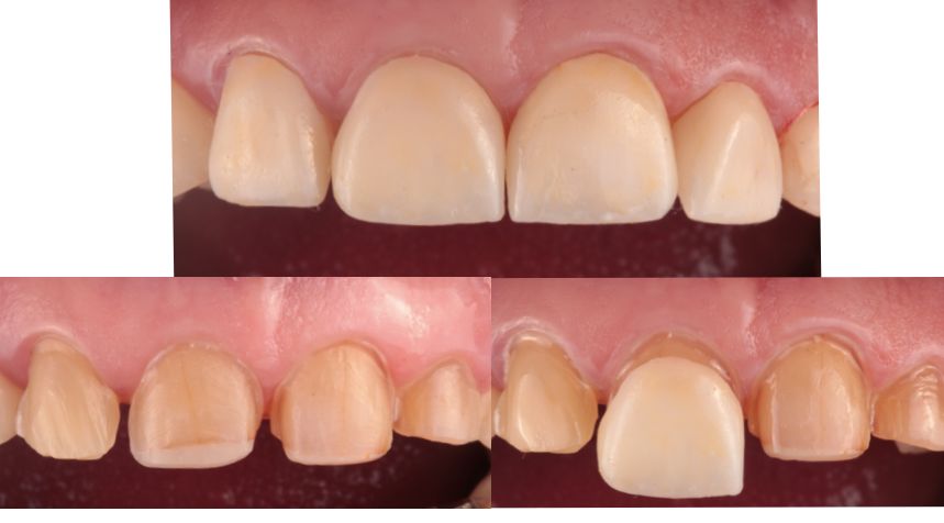 Andrea Cervantes Urenda-22