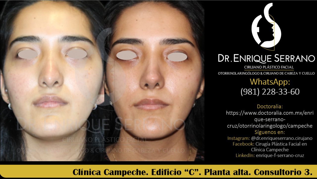 Enrique Serrano Cruz-65