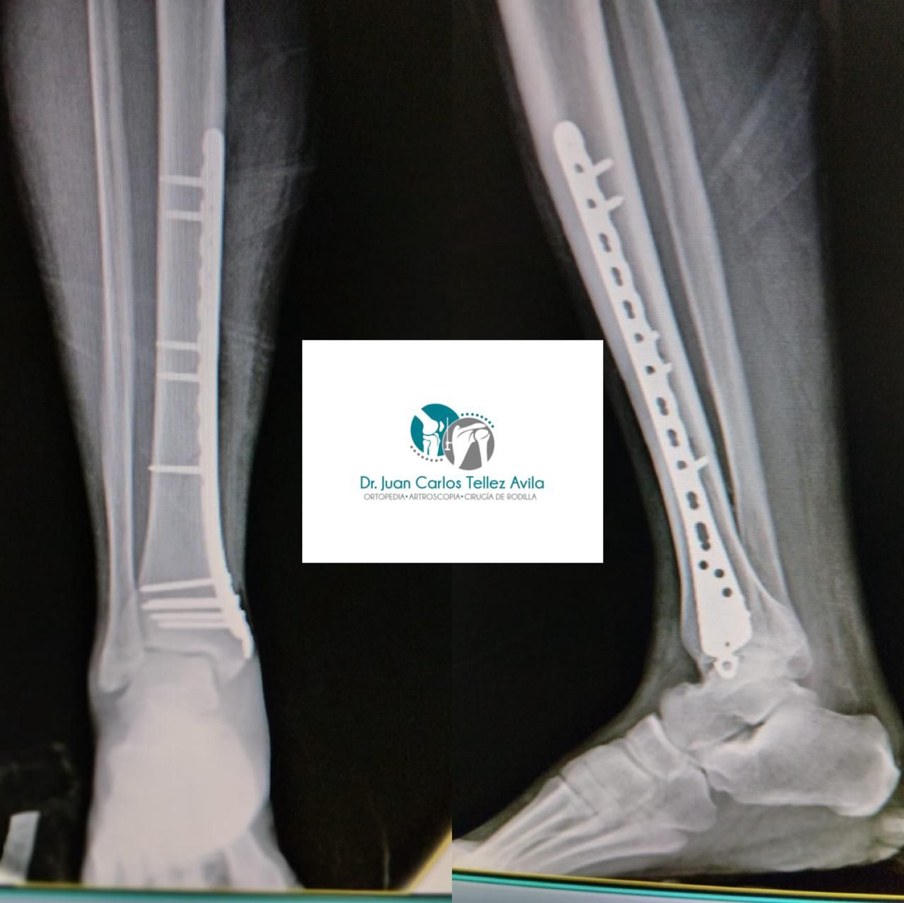 Juan Carlos Tellez Avila-15